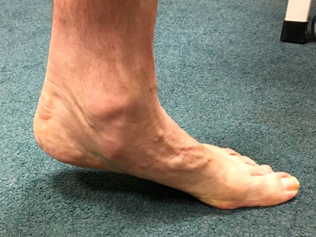 Trying to stand on tiptoe